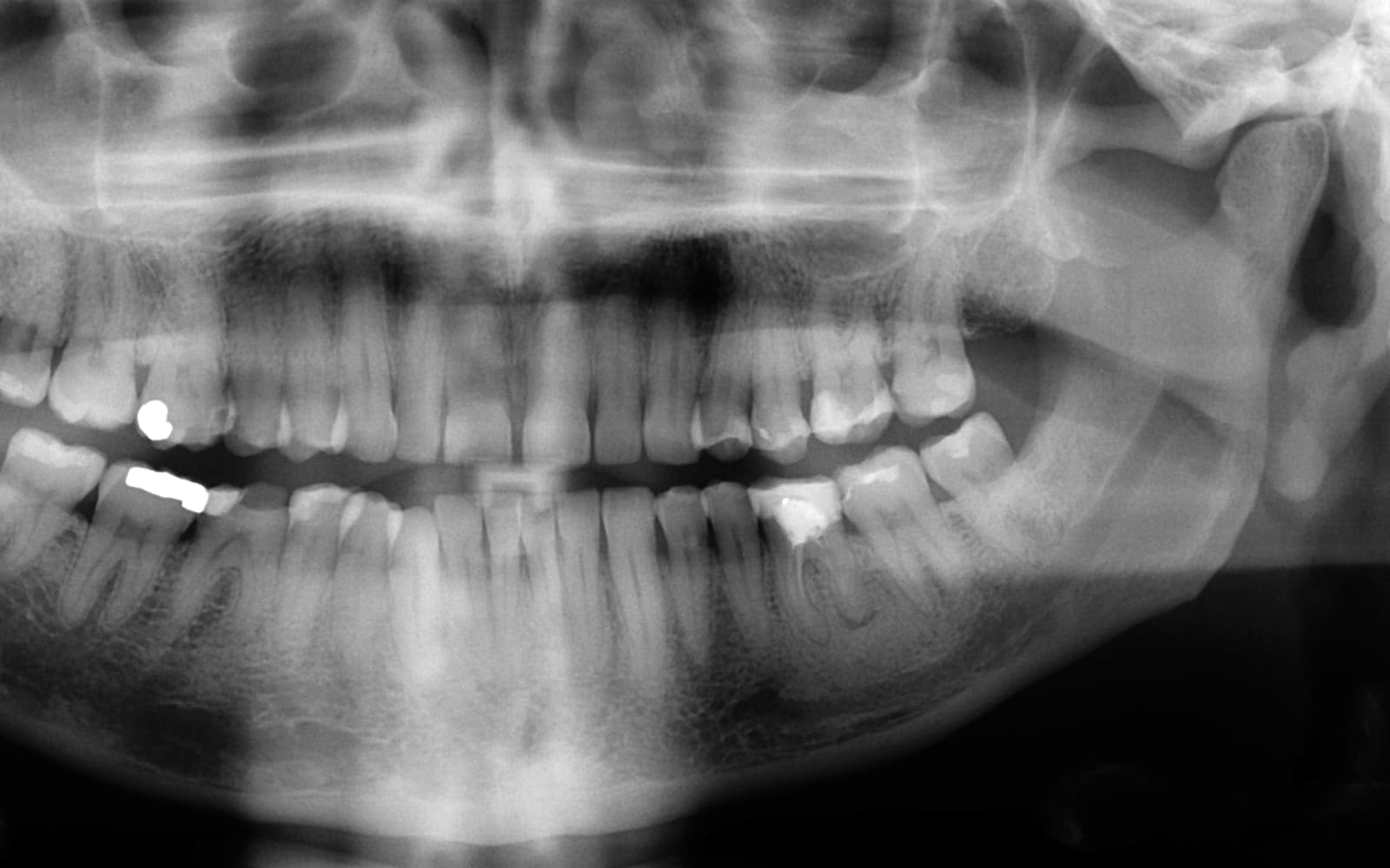 Dentist Near Sector 24, 25 and 27 Gurgaon