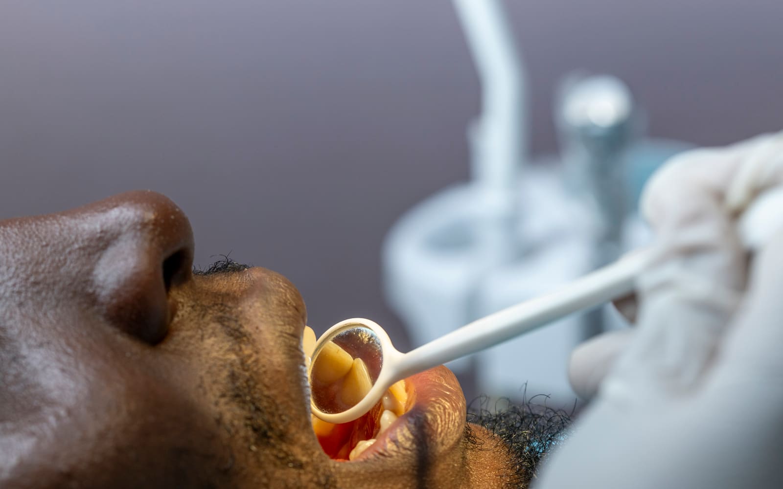 Dentist Near Sector 62 Gurgaon: How to Reach N Square Dental Care Clinic from M3M Route 65